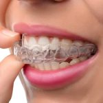 Understanding the Invisalign Doctor Site